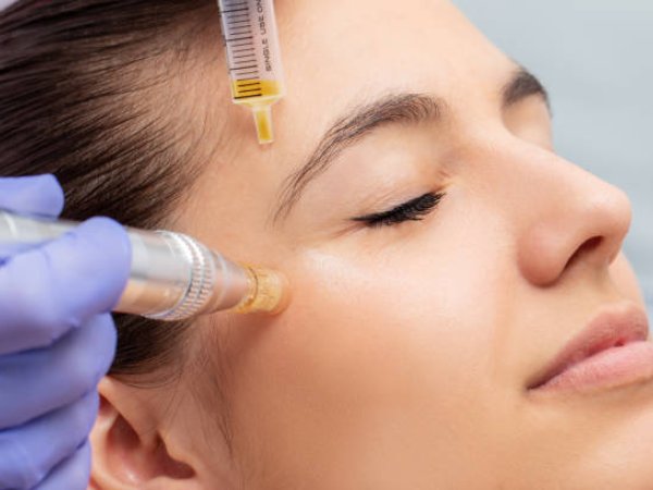 Skin Needling - DermaPen